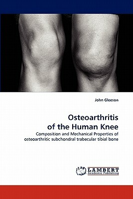 Osteoarthritis of the Human Knee by John Gleeson