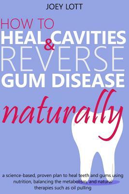How to Heal Cavities and Reverse Gum Disease Naturally: a science-based, proven plan to heal teeth and gums using nutrition, balancing the metabolism, by Joey Lott