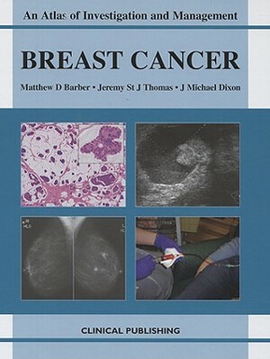 Breast Cancer: An Atlas of Investigation and Management by Jeremy St J. Thomas, J. Michael Dixon, Matthew D. Barber