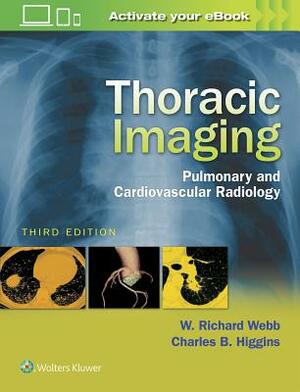 Thoracic Imaging: Pulmonary and Cardiovascular Radiology by Charles B. Higgins, W. Richard Webb