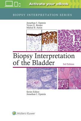 Biopsy Interpretation of the Bladder by Mahul B. Amin, Jonathan Epstein, Victor Reuter