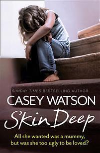 Skin Deep: All She Wanted Was a Mummy, But Was She Too Ugly to be Loved? by Casey Watson, Casey Watson