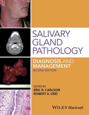 Salivary Gland Pathology: Diagnosis and Management by Eric R. Carlson, Robert A. Ord