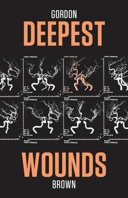 Deepest Wounds by Gordon Brown