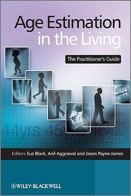 Age Estimation in the Living by Sue Black