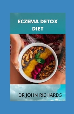 Eczema Detox Diet: Diet for Eliminating Skin Inflammation by John Richards