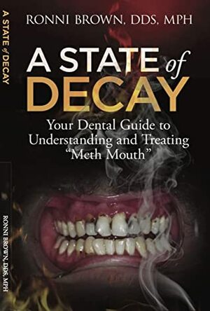 A State of Decay: Your Dental Guide to Understanding and Treating Meth Mouth by Ronni Brown DDS MPH