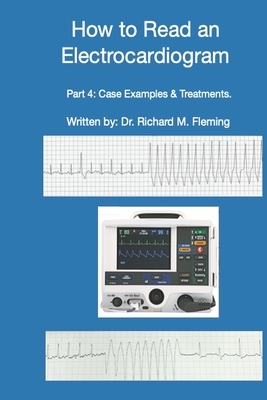 How to Read an Electrocardiogram - Part 4: Case Examples & Treatments. by Richard M. Fleming