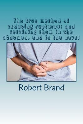 The true method of reducing ruptures: and retaining them in the abdomen, and in the navel by Robert Brand