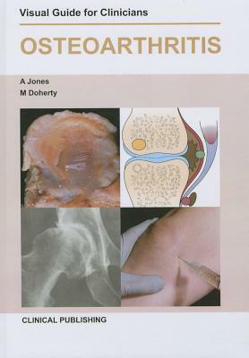 Osteoarthritis: Visual Guide for Clinicians by Michael Doherty, Adrian Jones