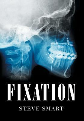 Fixation by Steve Smart