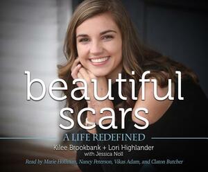 Beautiful Scars: A Life Redefined by Lori Highlander, Kilee Brookbank