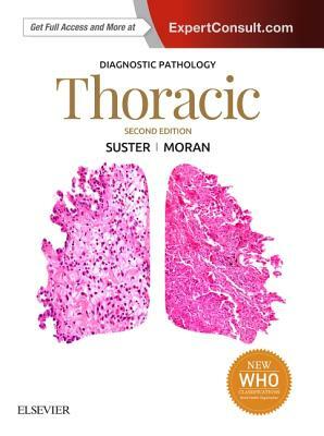 Diagnostic Pathology: Thoracic by Saul Suster, Cesar A. Moran