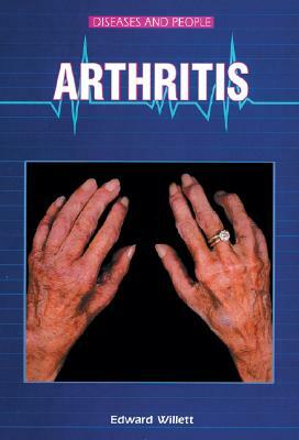 Arthritis by Edward Willett