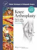 Knee Arthroplasty by Jess H. Lonner, Paul A. Lotke