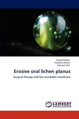 Erosive Oral Lichen Planus by Anoop Kapoor, Poonam Sikri, Vishakha Grover