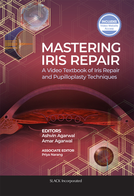 Mastering Iris Repair: A Video Textbook of Iris Repair and Pupilloplasty Techniques by Amar Agarwal, Ashvin Agarwal