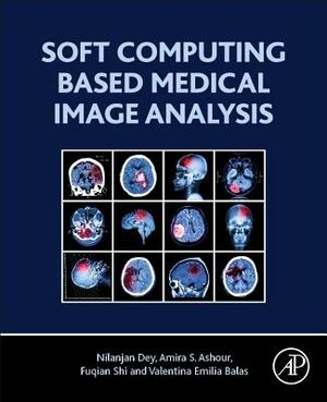 Soft Computing Based Medical Image Analysis by Nilanjan Dey, Fuquian Shi, Amira S. Ashour