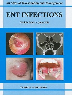 ENT Infections: An Atlas of Investigation and Management by Vinidh Paleri, John Hill