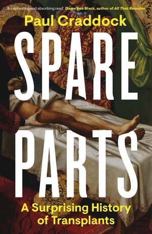 Spare Parts: A Surprising History of Transplants by Paul Craddock