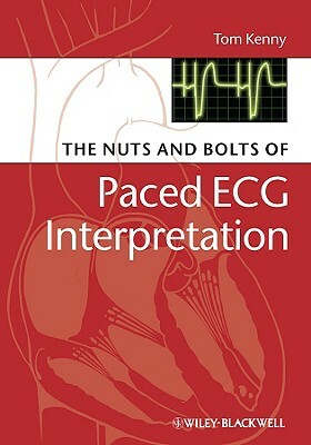 The Nuts and Bolts of Paced ECG Interpretation by Tom Kenny