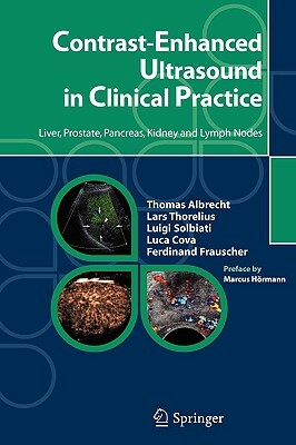 Contrast-Enhanced Ultrasound in Clinical Practice: Liver, Prostate, Pancreas, Kidney and Lymph Nodes by Lars Thorelius, Thomas Albrecht