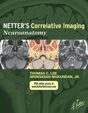 Netter's Correlative Imaging: Neuroanatomy E-Book: With Netterreference.com Access by Nancy M. Major, Thomas C. Lee, Gerald Grant, Srinivasan Mukundan Jr.