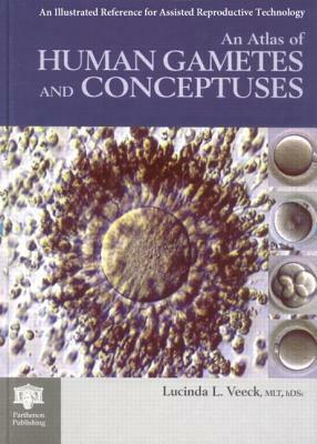 An Atlas of Human Gametes and Conceptuses: An Illustrated Reference for Assisted Reproductive Technology by 