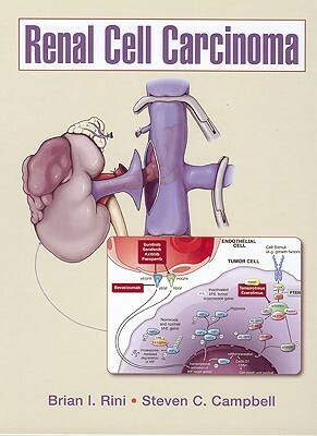 Renal Cell Carcinoma by Steven C. Campbell, Brian I. Rini