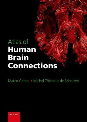 Atlas of Human Brain Connections by Marco Catani, Michel Thiebaut De Schotten