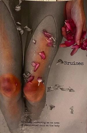 Bruises by Adam Shove