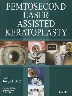 Femtosecond Laser-Assisted Keratoplasty by Jorge L. Alio