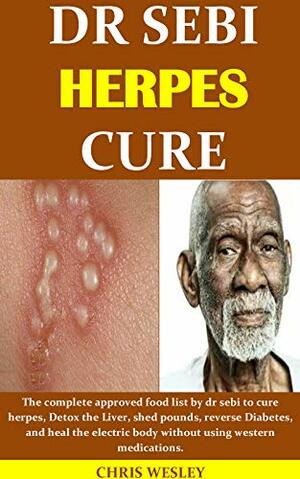 DR SEBI HERPES CURE: The complete approved food list by dr sebi to cure herpes, Detox the Liver, shed pounds, reverse Diabetes, and heal the electric body without using western medications. by Chris Wesley