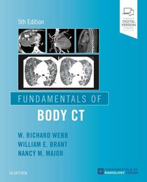 Fundamentals of Body CT by Wiliam E. Brant, Nancy M. Major, W. Richard Webb