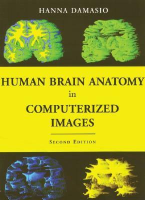 Human Brain Anatomy in Computerized Images by Hanna Damasio