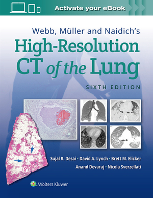 Webb, Müller and Naidich's High-Resolution CT of the Lung by David Lynch, Anand Devaraj, Sujal Desai