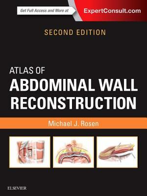 Atlas of Abdominal Wall Reconstruction: Expert Consult - Online and Print by Michael J. Rosen