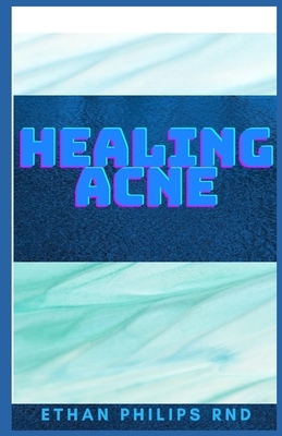 Healing Acne: A Complete Guide On Acne, How It Affects And How To Overcome It by Ethan Phillips