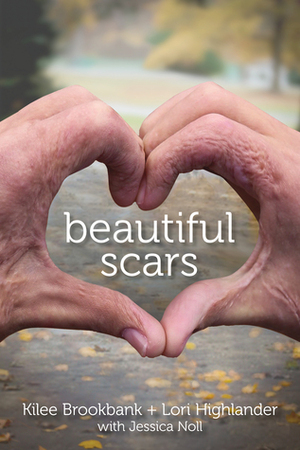 Beautiful Scars by Lori Highlander, Kilee Brookbank