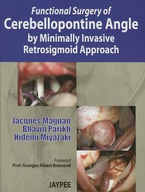 Functional Surgery of Cerebellopontine Angle by Minimally Invasive Retrosigmoid Approach by Hidemi Miyazaki, Jacques Magnan, Bhavin Parikh