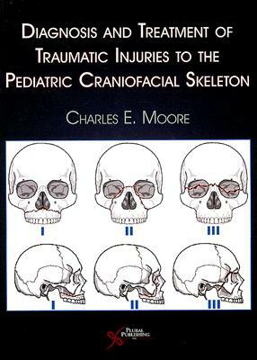 Diagnosis and Treatment of Traumatic Injuries to the Pediatric Craniofacial Skeleton by Charles E. Moore