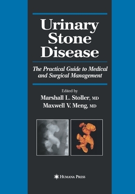 Urinary Stone Disease: The Practical Guide to Medical and Surgical Management by 
