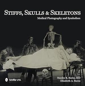 Stiffs, Skulls & Skeletons: Medical Photography and Symbolism by Elizabeth A. Burns, Stanley B. Burns