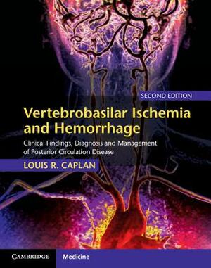 Vertebrobasilar Ischemia and Hemorrhage: Clinical Findings, Diagnosis and Management of Posterior Circulation Disease by Louis R. Caplan