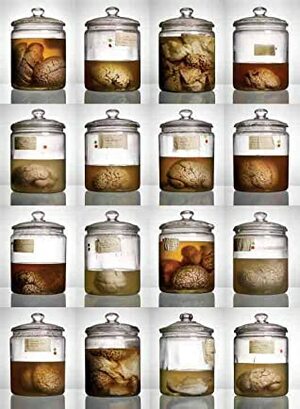 Malformed: Forgotten Brains of the Texas State Mental Hospital by Adam Voorhes, Alex Hannaford