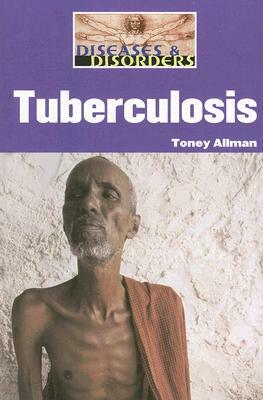 Tuberculosis by Toney Allman