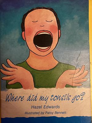 Where Did My Tonsils Go? by Hazel Edwards