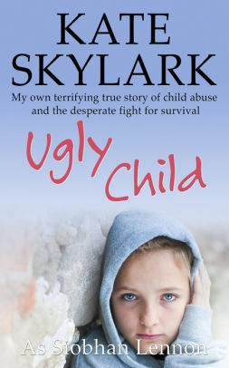 Ugly Child: My Own Terrifying True Story of Child Abuse and the Desperate Fight for Survival by Siobhan Lennon, Kate Skylark