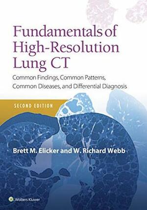 Fundamentals of High-Resolution Lung CT: Common Findings, Common Patterns, Common Diseases and Differential Diagnosis (Pocket Notebook) by Brett M. Elicker, W. Richard Webb