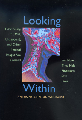 Looking Within: How X-Ray, Ct, Mri, Ultrasound, and Other Medical Images Are Created, and How They Help Physicians Save Lives by Anthony Brinton Wolbarst